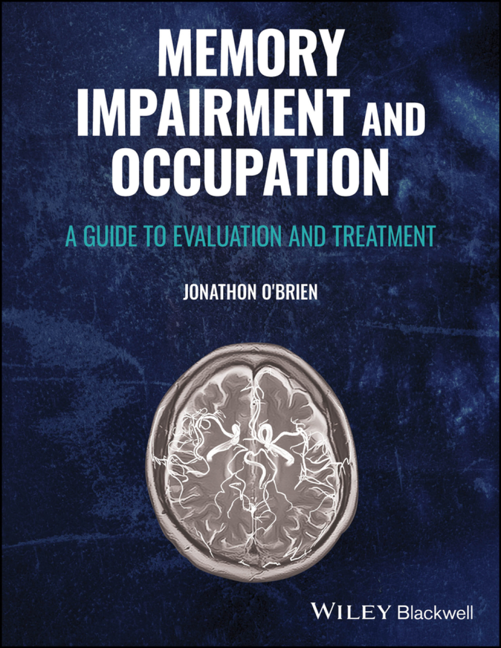 Memory Impairment and Occupation A Guide to Evaluation and Treatment 1st Edition â€“ PDF/EPUB Version Downloadable