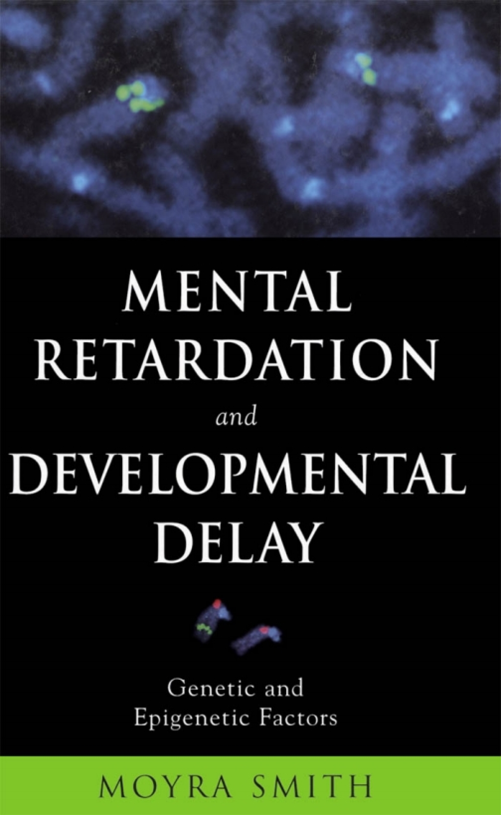 Mental Retardation and Developmental Delay Genetic and Epigenetic Factors  â€“ PDF/EPUB Version Downloadable