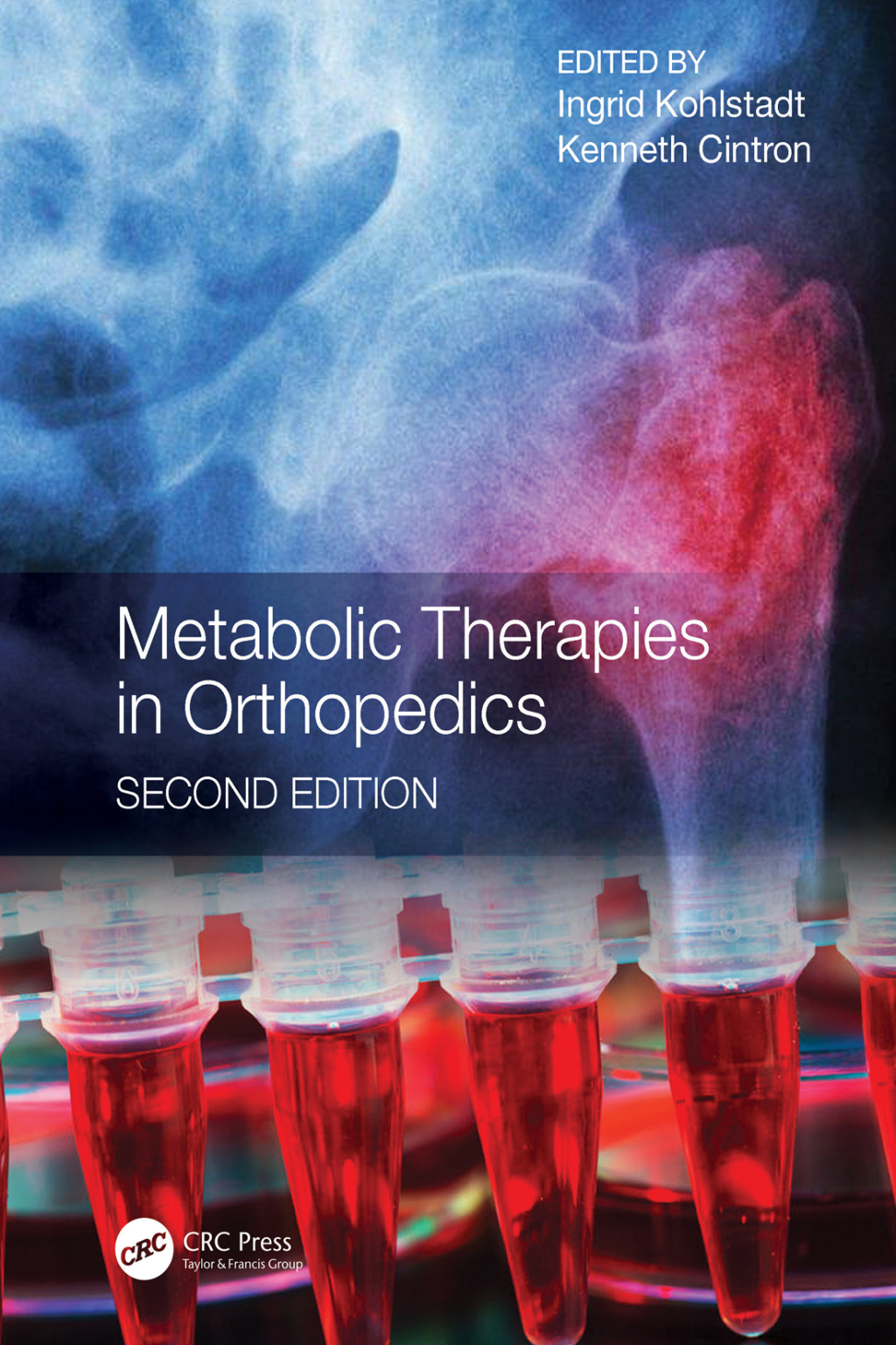 Metabolic Therapies in Orthopedics, Second Edition 2nd Edition â€“ PDF/EPUB Version Downloadable