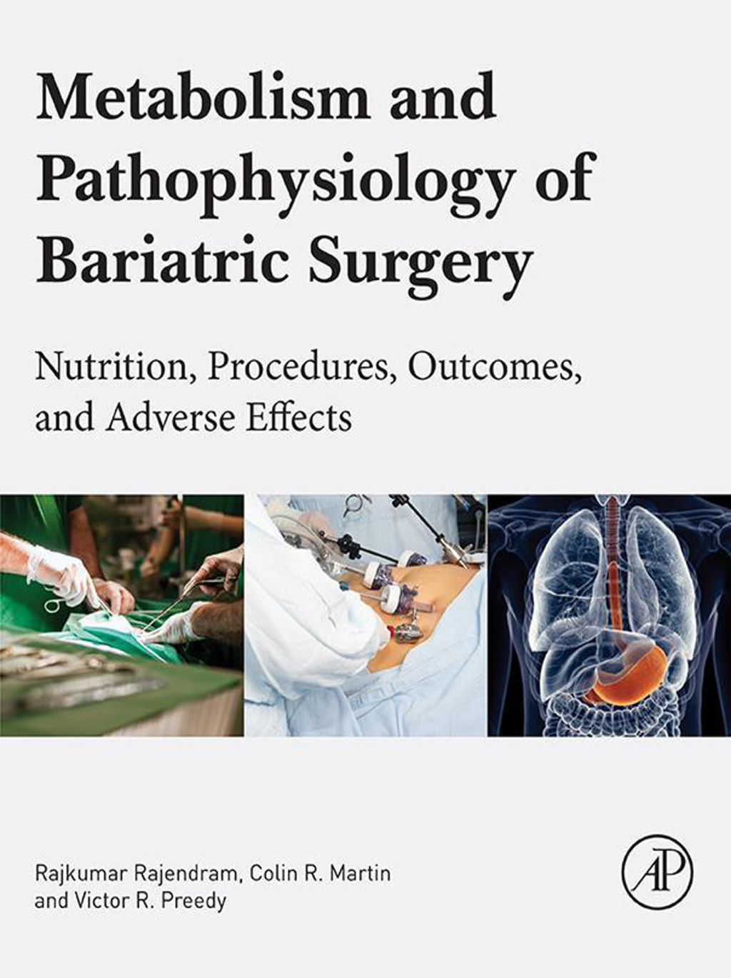 Metabolism and Pathophysiology of Bariatric Surgery Nutrition, Procedures, Outcomes and Adverse Effects  â€“ PDF/EPUB Version Downloadable