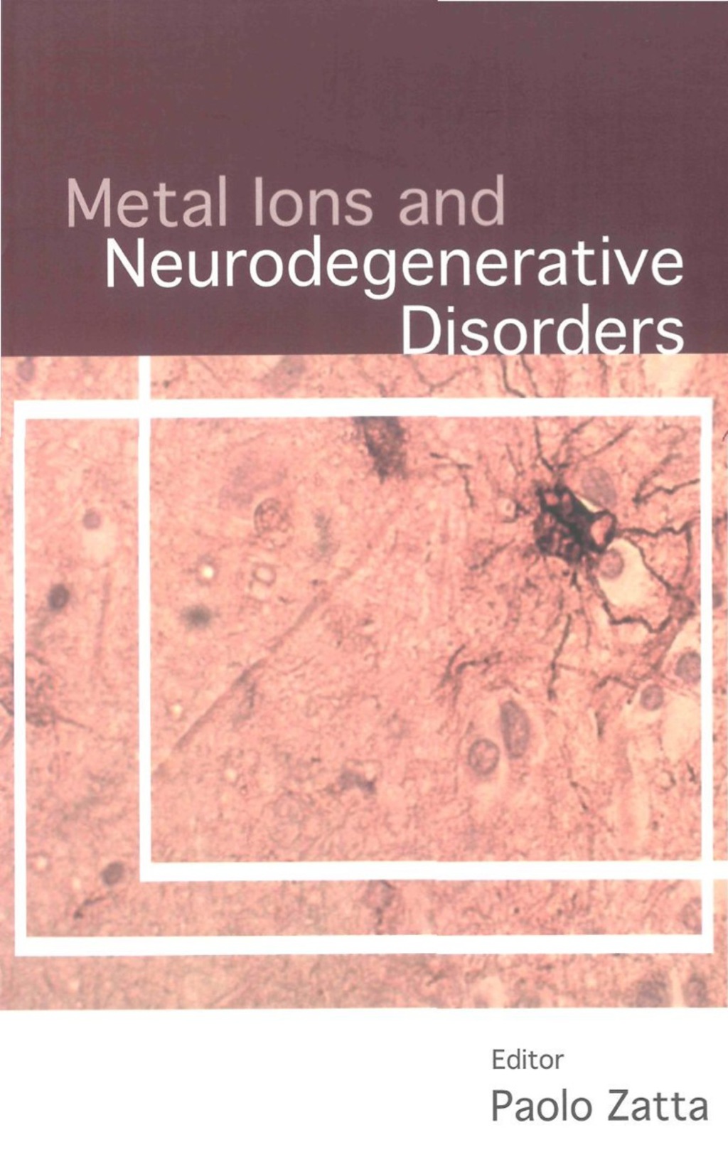 METAL IONS & NEURODEGENERATIVE DISORDERS  â€“ PDF/EPUB Version Downloadable