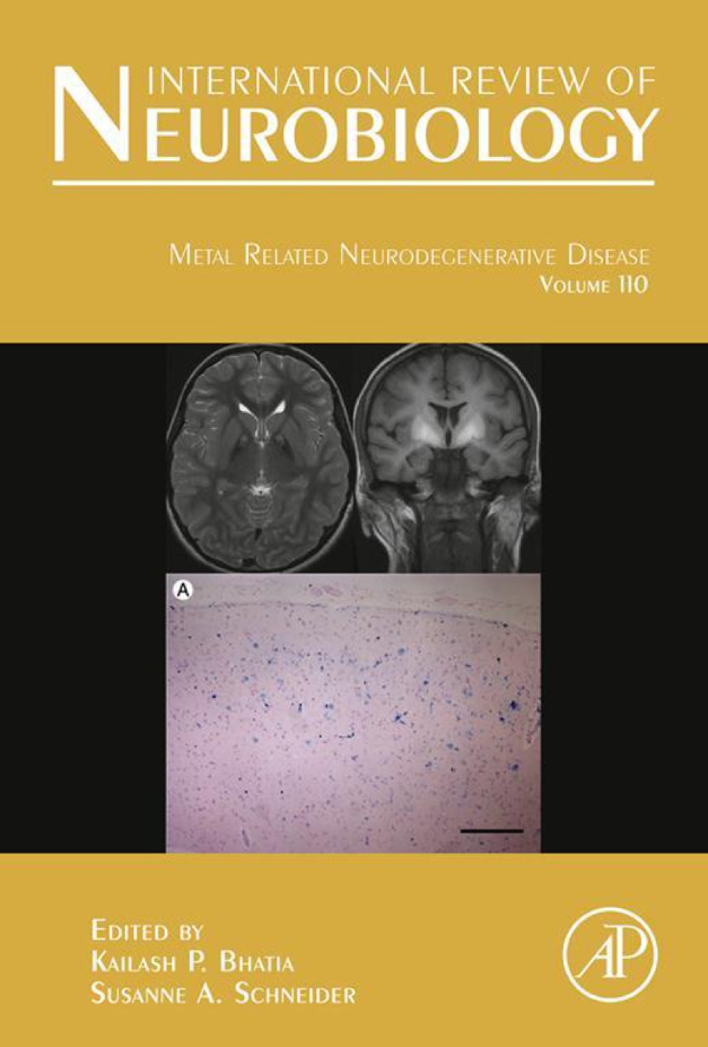 Metal Related Neurodegenerative Disease  â€“ PDF/EPUB Version Downloadable