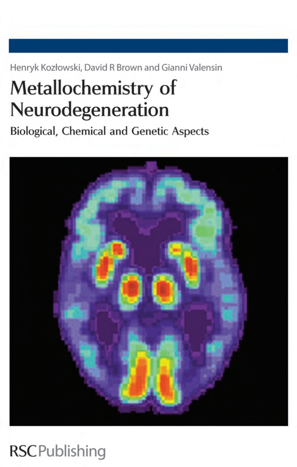 Metallochemistry of Neurodegeneration Biological, Chemical and Genetic Aspects 1st Edition â€“ PDF/EPUB Version Downloadable