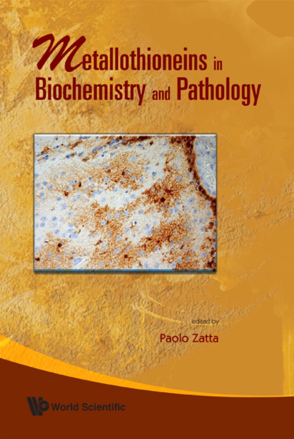 METALLOTHIONEINS IN BIOCHEMISTRY &...  â€“ PDF/EPUB Version Downloadable