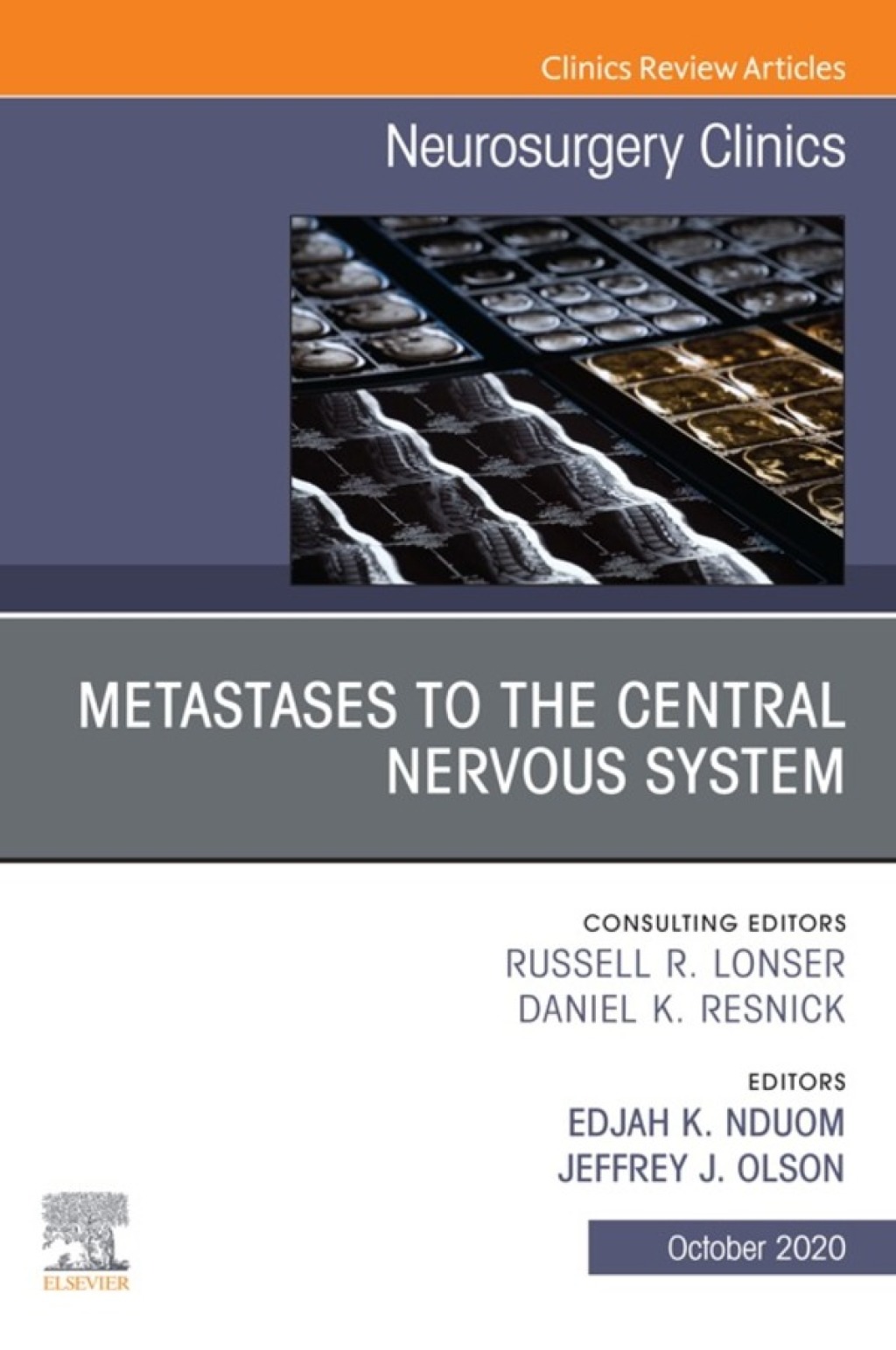 Metastases to the Central Nervous System, An Issue of Neurosurgery Clinics of North America 1st Edition â€“ PDF/EPUB Version Downloadable