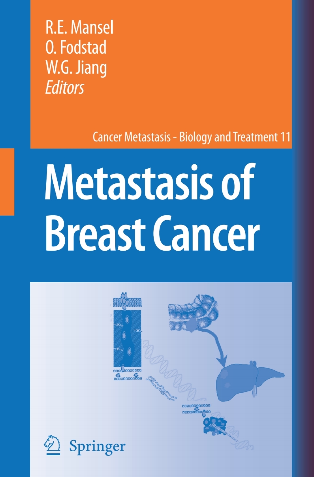 Metastasis of Breast Cancer 1st Edition â€“ PDF/EPUB Version Downloadable