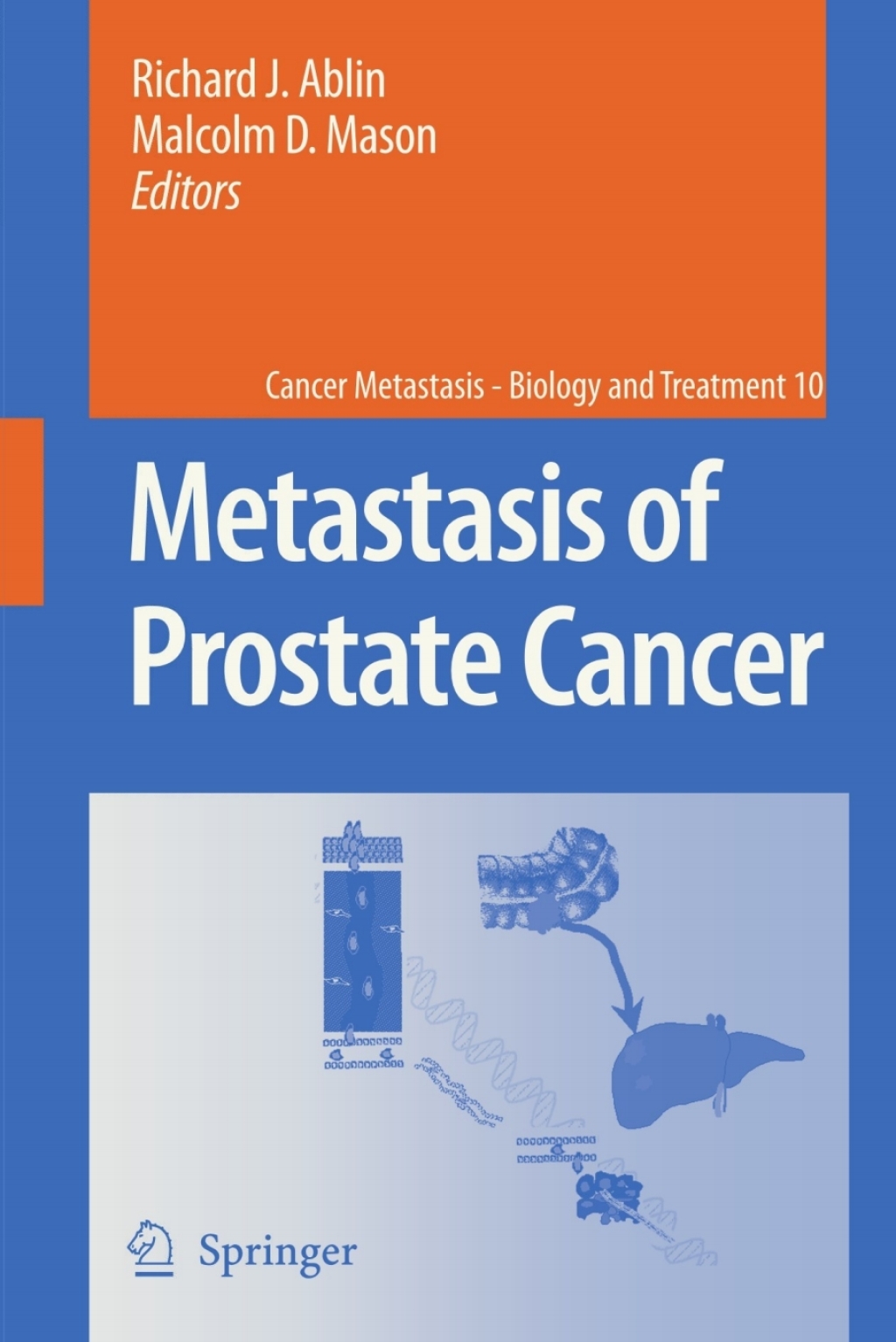 Metastasis of Prostate Cancer 1st Edition â€“ PDF/EPUB Version Downloadable