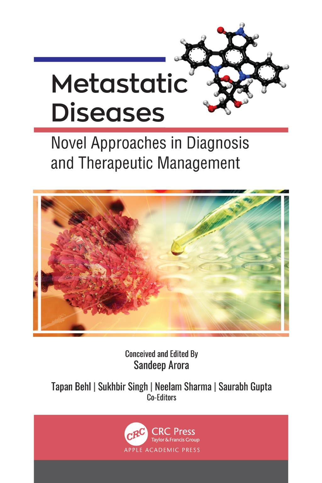 Metastatic Diseases Novel Approaches in Diagnosis and Therapeutic Management 1st Edition â€“ PDF/EPUB Version Downloadable