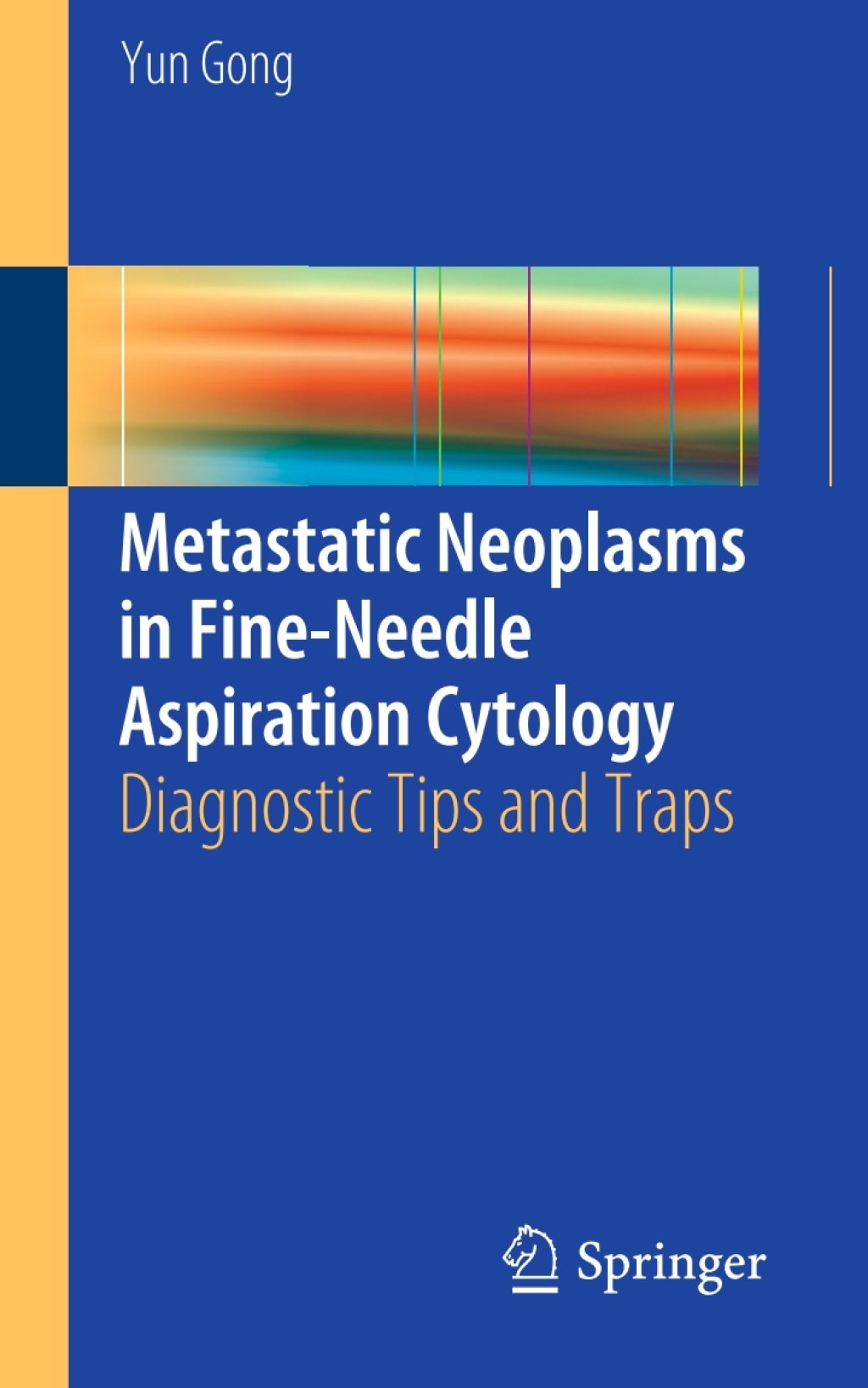 Metastatic Neoplasms in Fine-Needle Aspiration Cytology Diagnostic Tips and Traps  â€“ PDF/EPUB Version Downloadable