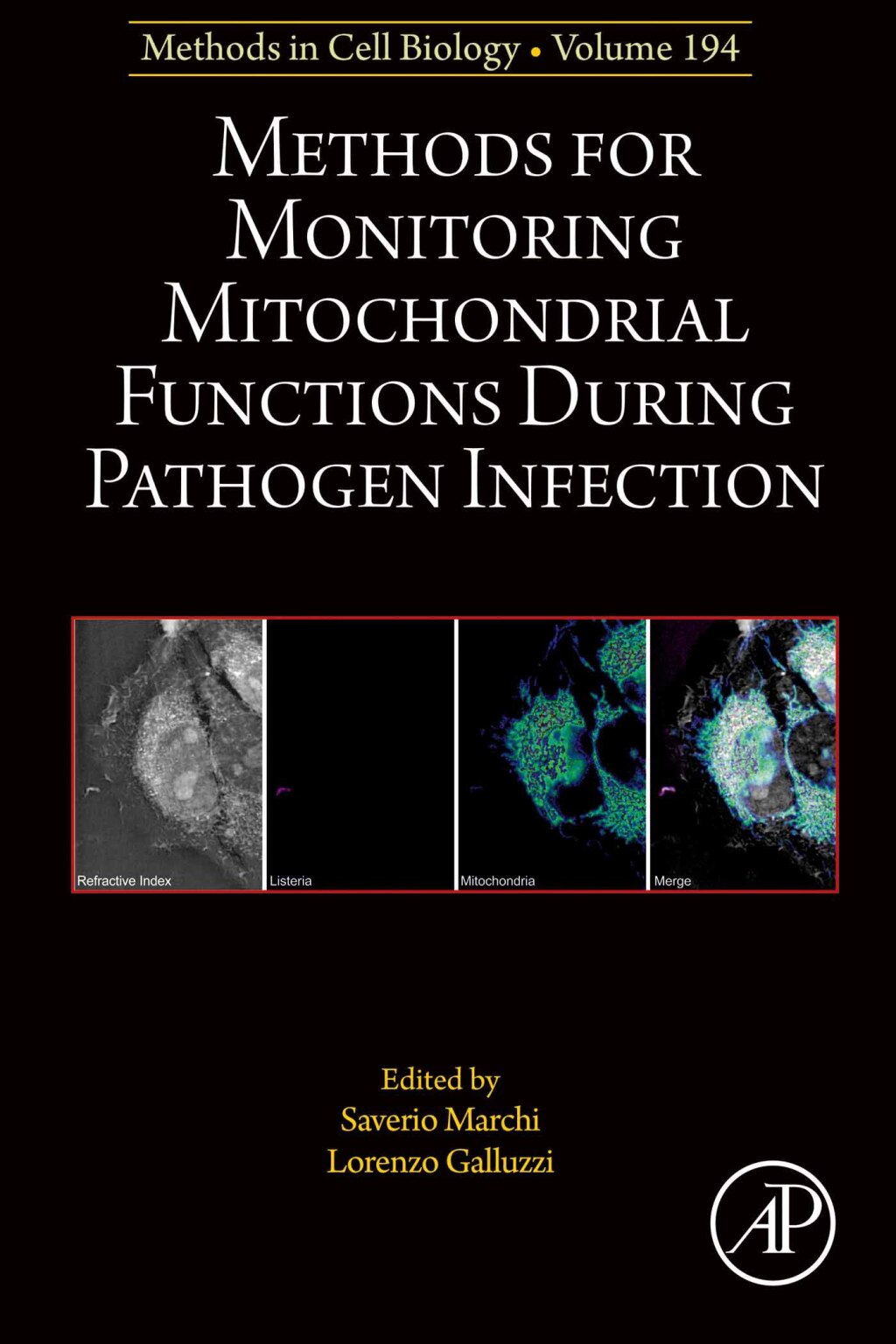 Methods for Monitoring Mitochondrial Functions During Pathogen Infection  â€“ PDF/EPUB Version Downloadable
