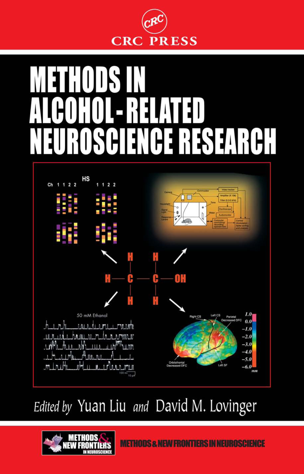 Methods in Alcohol-Related Neuroscience Research 1st Edition â€“ PDF/EPUB Version Downloadable