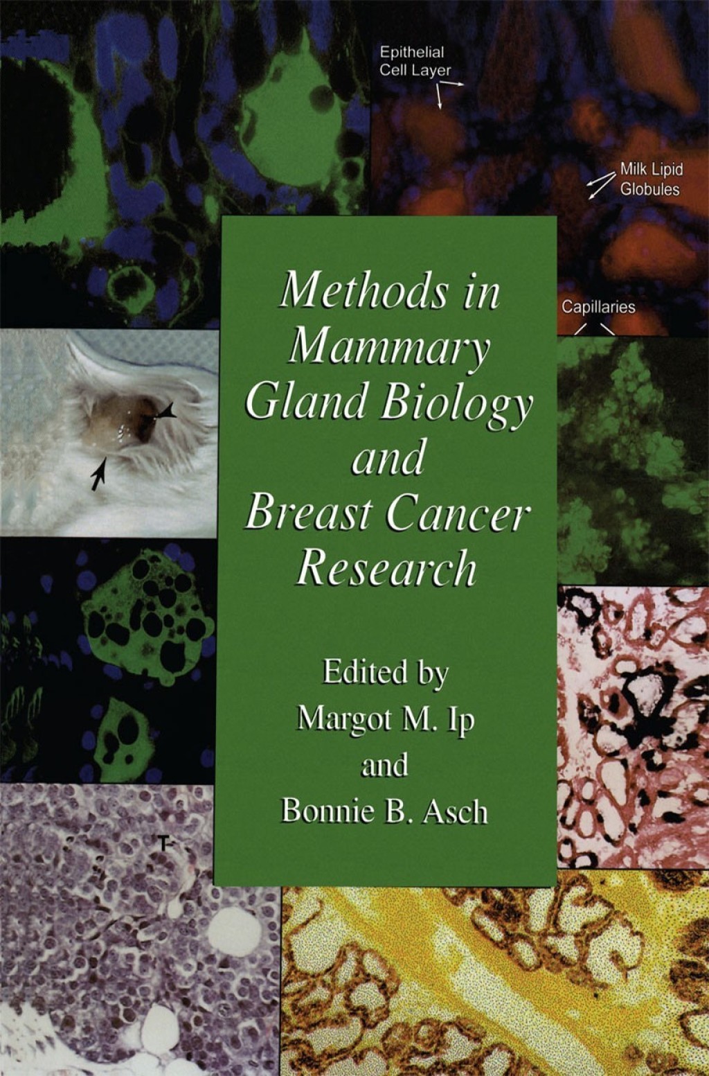 Methods in Mammary Gland Biology and Breast Cancer Research 1st Edition â€“ PDF/EPUB Version Downloadable