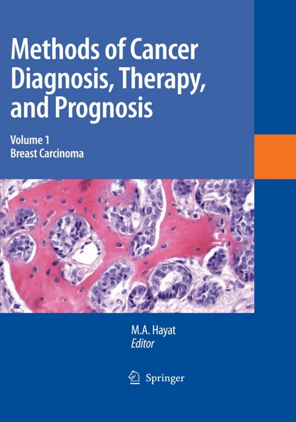 Methods of Cancer Diagnosis, Therapy and Prognosis Breast Carcinoma 1st Edition â€“ PDF/EPUB Version Downloadable