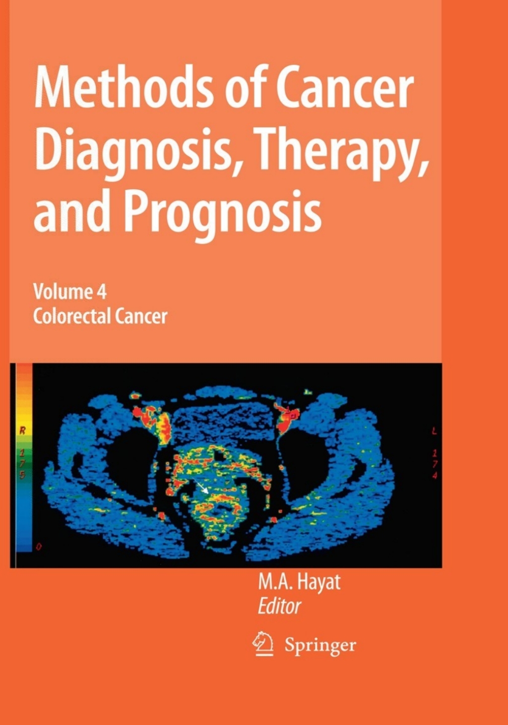 Methods of Cancer Diagnosis, Therapy and Prognosis Colorectal Cancer 1st Edition â€“ PDF/EPUB Version Downloadable