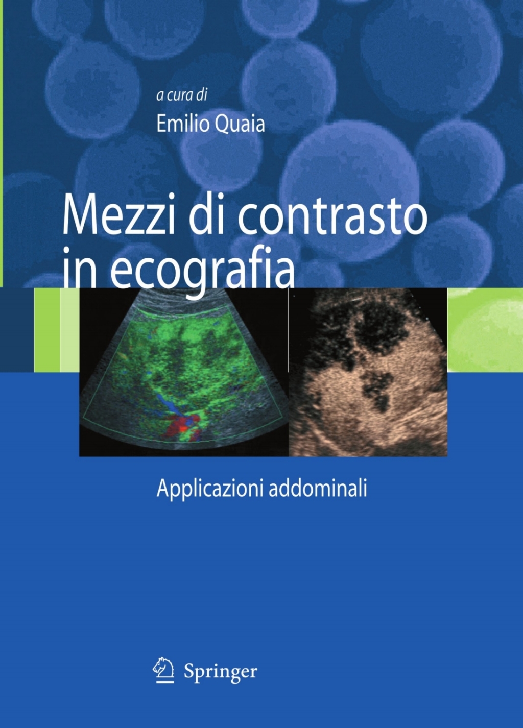 Mezzi di contrasto in ecografia Applicazioni addominali 1st Edition â€“ PDF/EPUB Version Downloadable