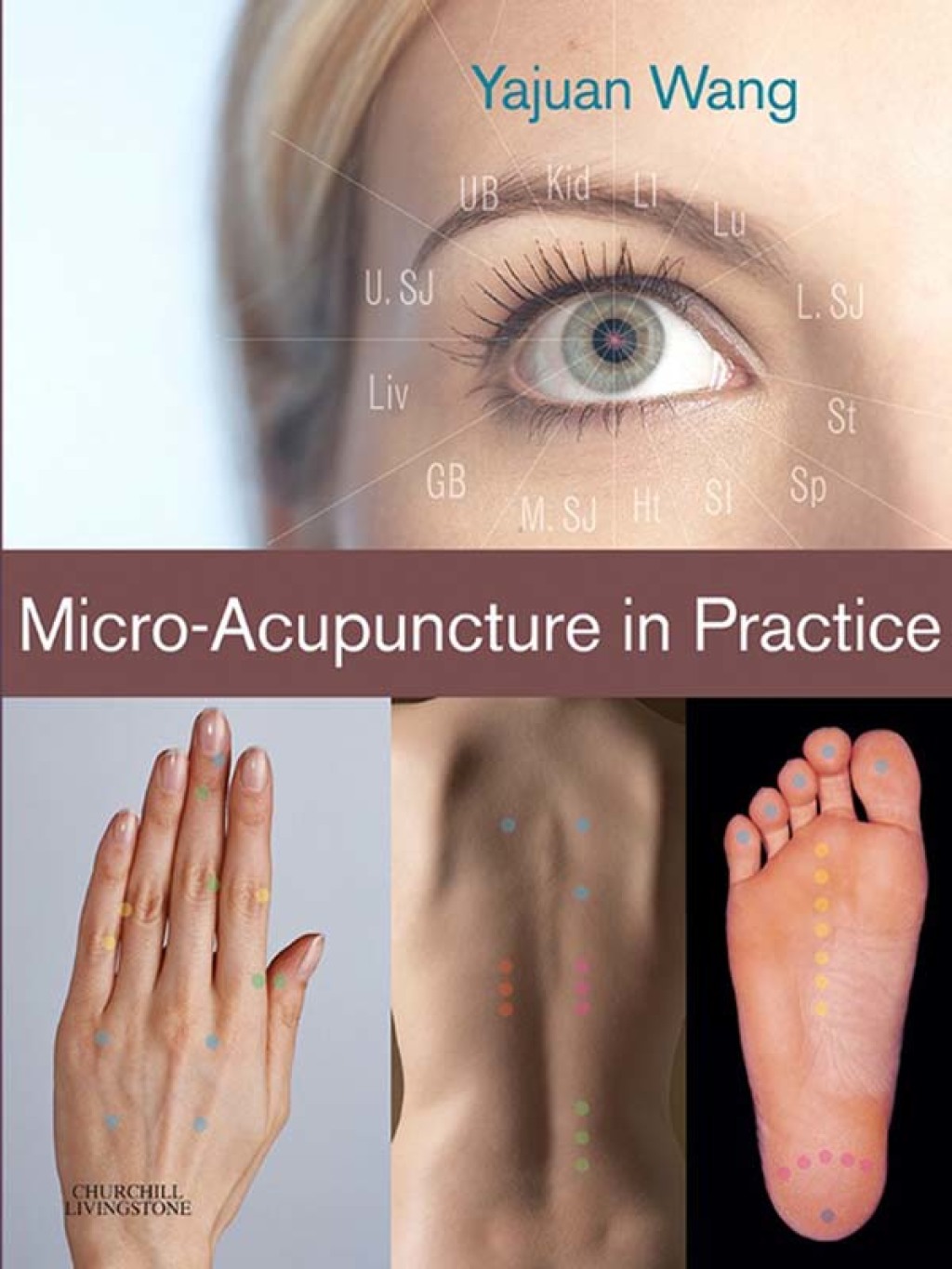 Micro-Acupuncture in Practice  â€“ PDF/EPUB Version Downloadable