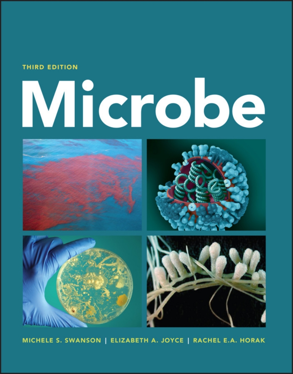 Microbe 3rd Edition â€“ PDF/EPUB Version Downloadable