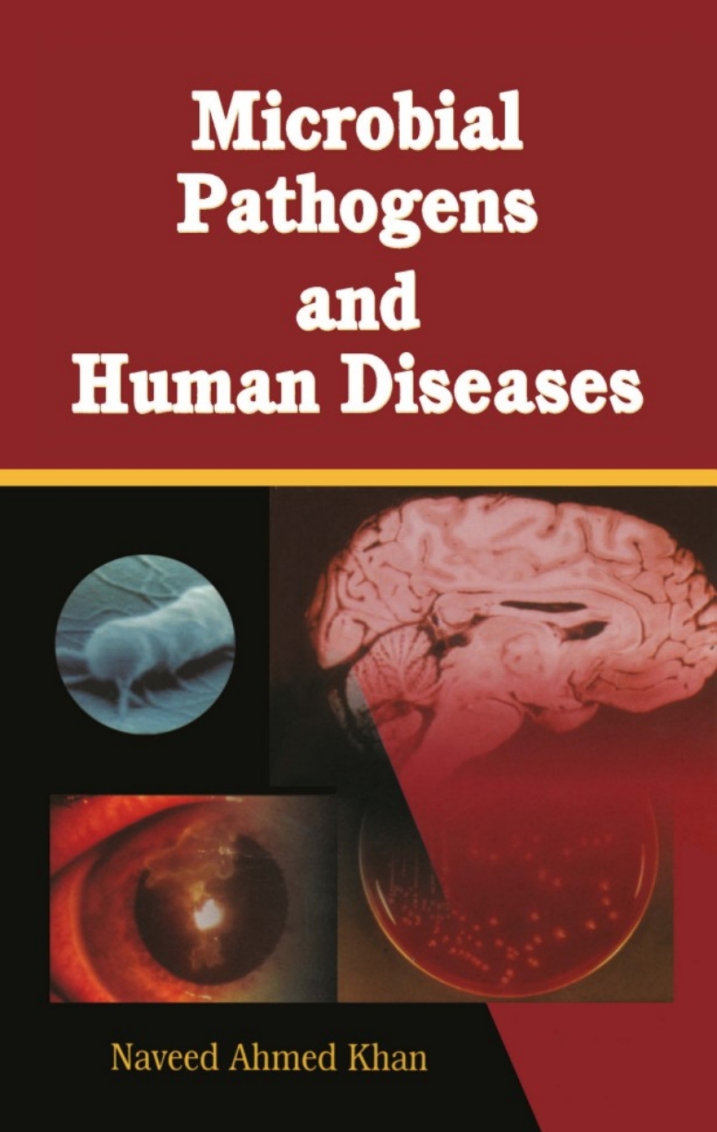 Microbial Pathogens and Human Diseases 1st Edition â€“ PDF/EPUB Version Downloadable