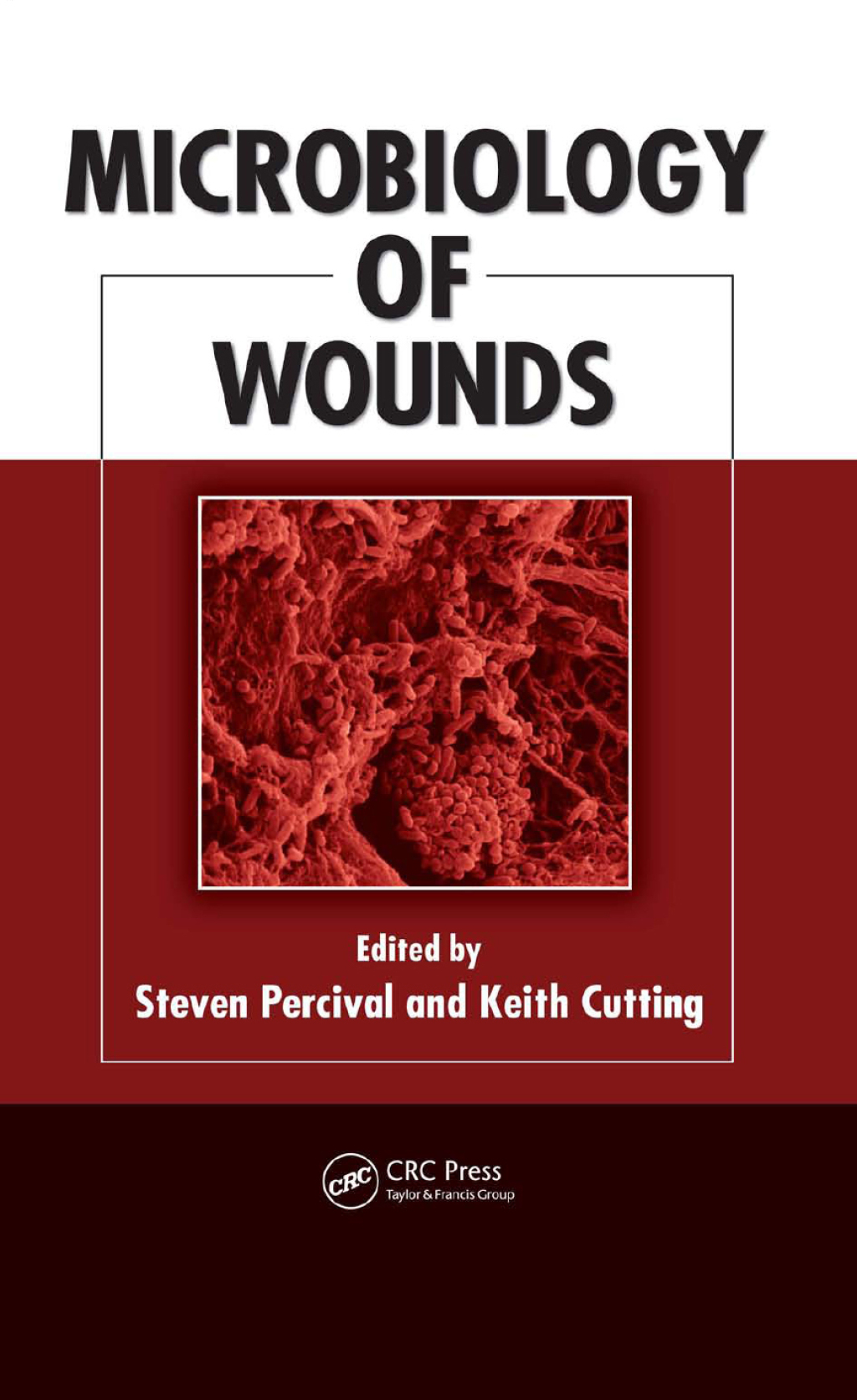 Microbiology of Wounds 1st Edition â€“ PDF/EPUB Version Downloadable