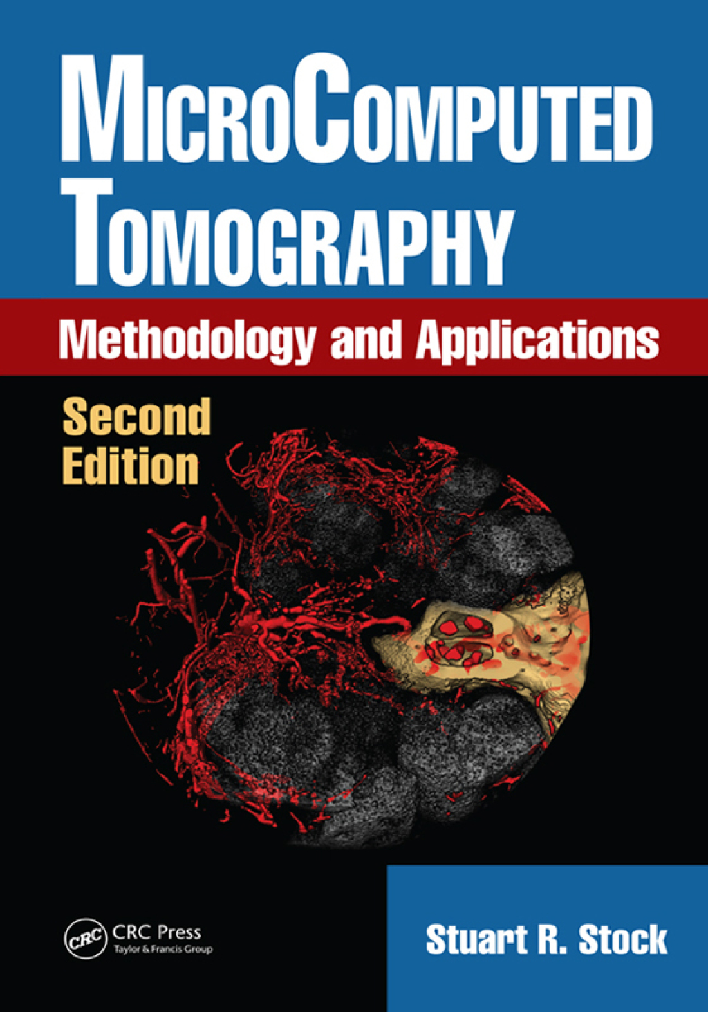 MicroComputed Tomography Methodology and Applications 2nd Edition â€“ PDF/EPUB Version Downloadable