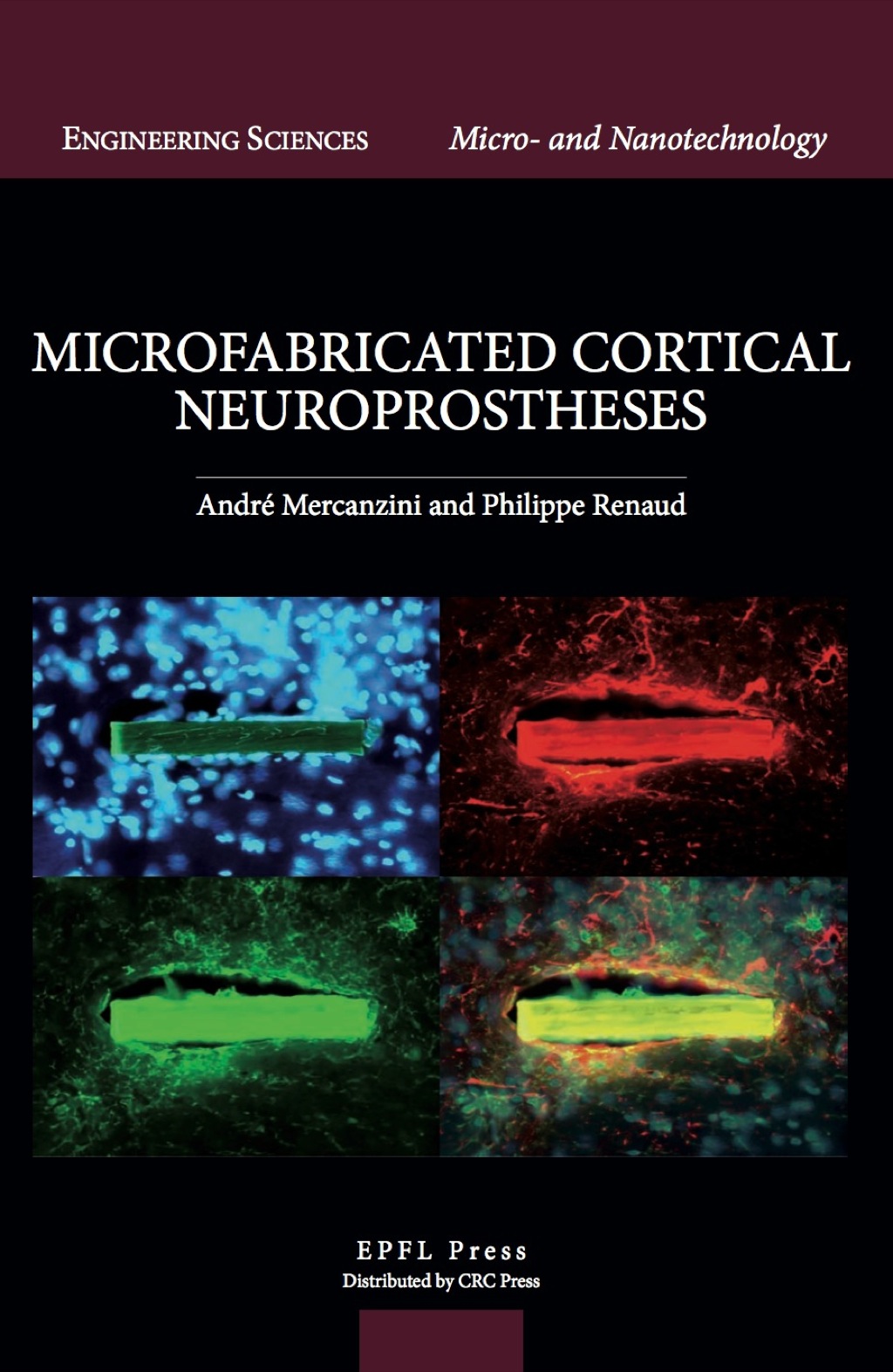 Microfabricated Cortical Neuroprostheses 1st Edition â€“ PDF/EPUB Version Downloadable