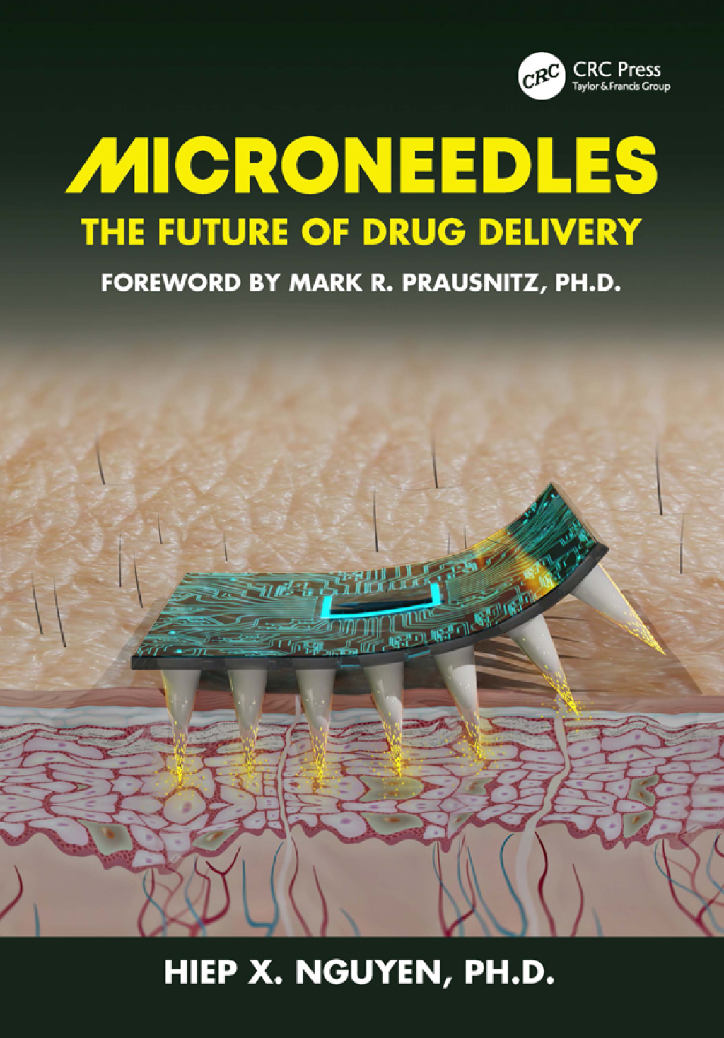 Microneedles The Future of Drug Delivery 1st Edition â€“ PDF/EPUB Version Downloadable