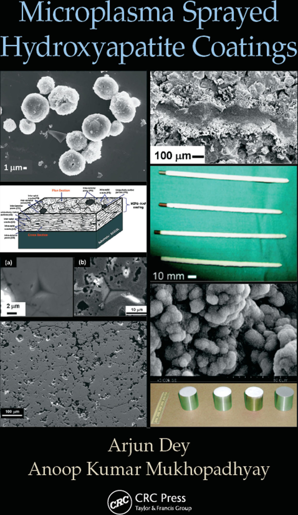 Microplasma Sprayed Hydroxyapatite Coatings 1st Edition â€“ PDF/EPUB Version Downloadable