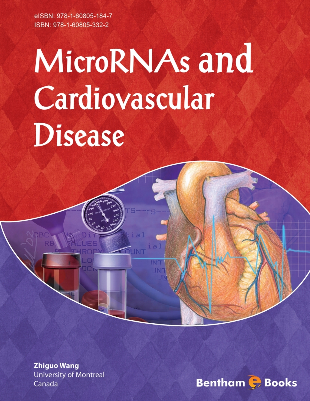 MicroRNAs and Cardiovascular Disease 1st Edition â€“ PDF/EPUB Version Downloadable