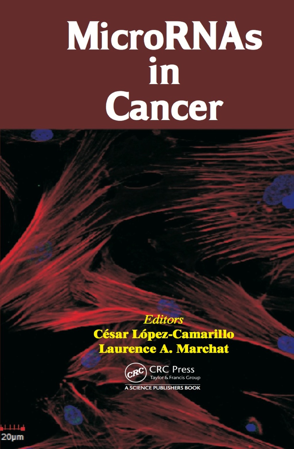 MicroRNAs in Cancer 1st Edition â€“ PDF/EPUB Version Downloadable