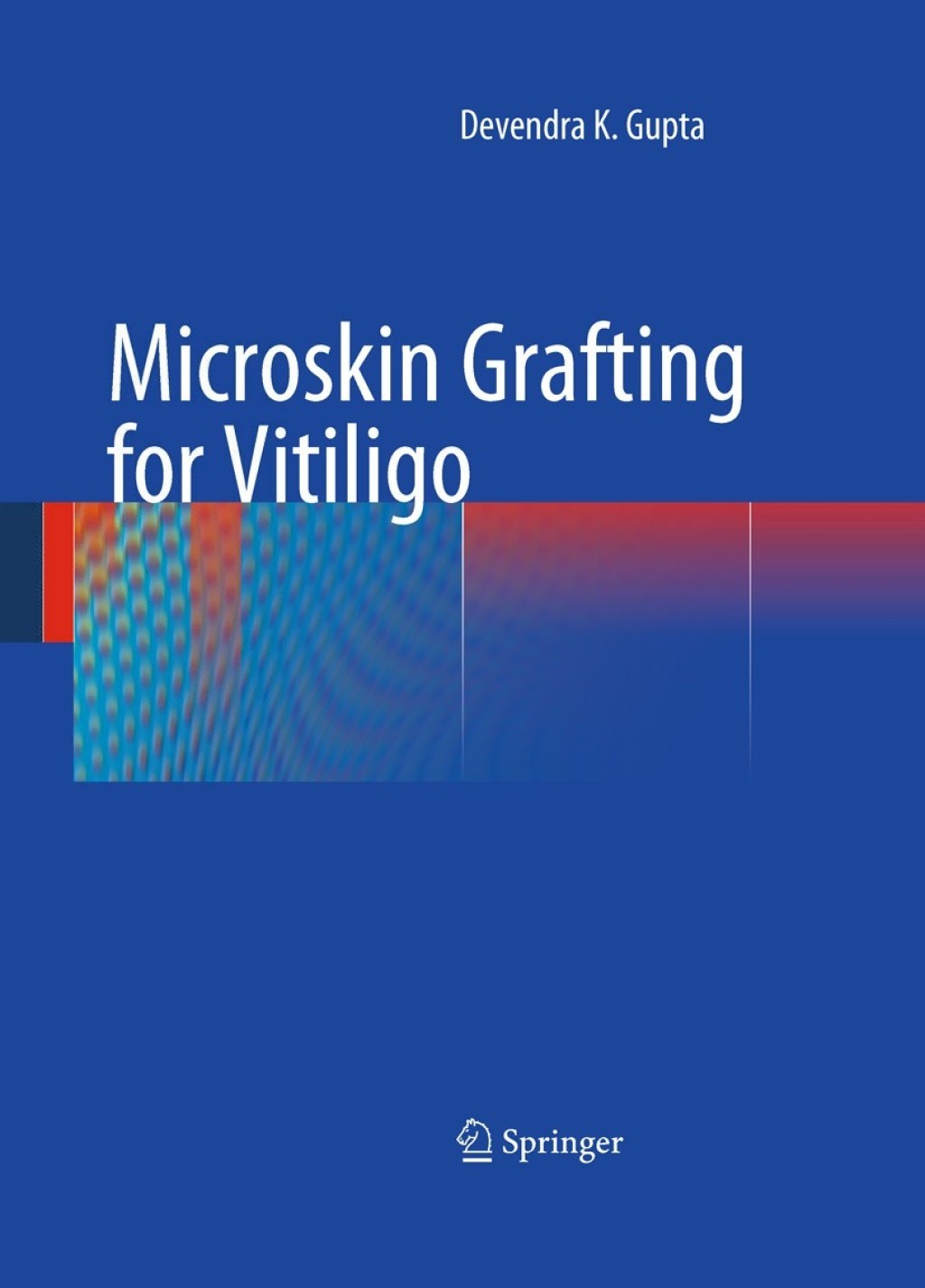 Microskin Grafting for Vitiligo  â€“ PDF/EPUB Version Downloadable