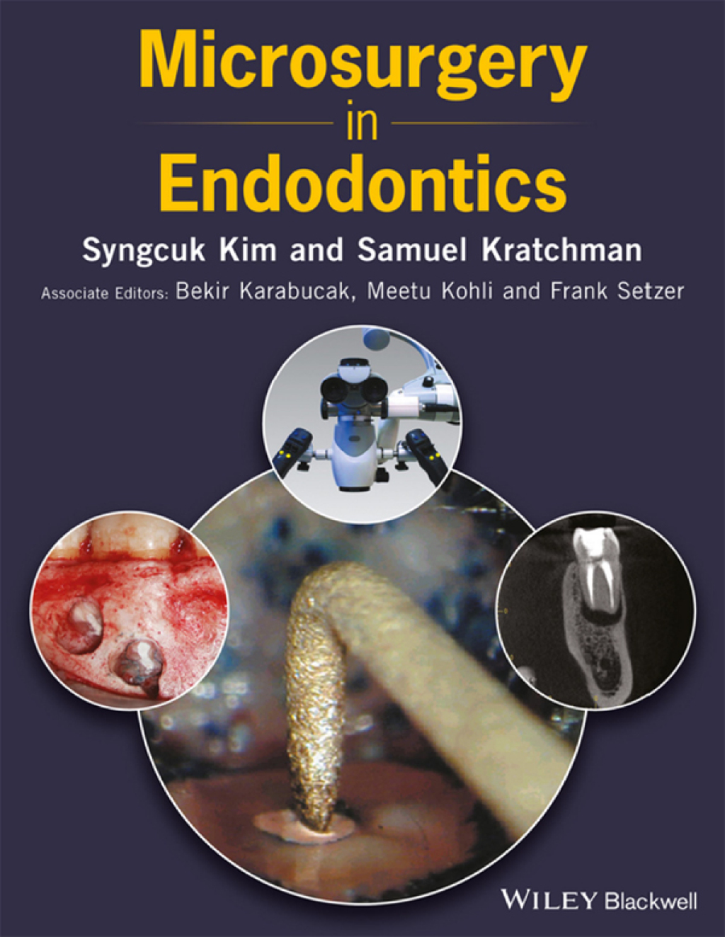 Microsurgery in Endodontics 1st Edition â€“ PDF/EPUB Version Downloadable