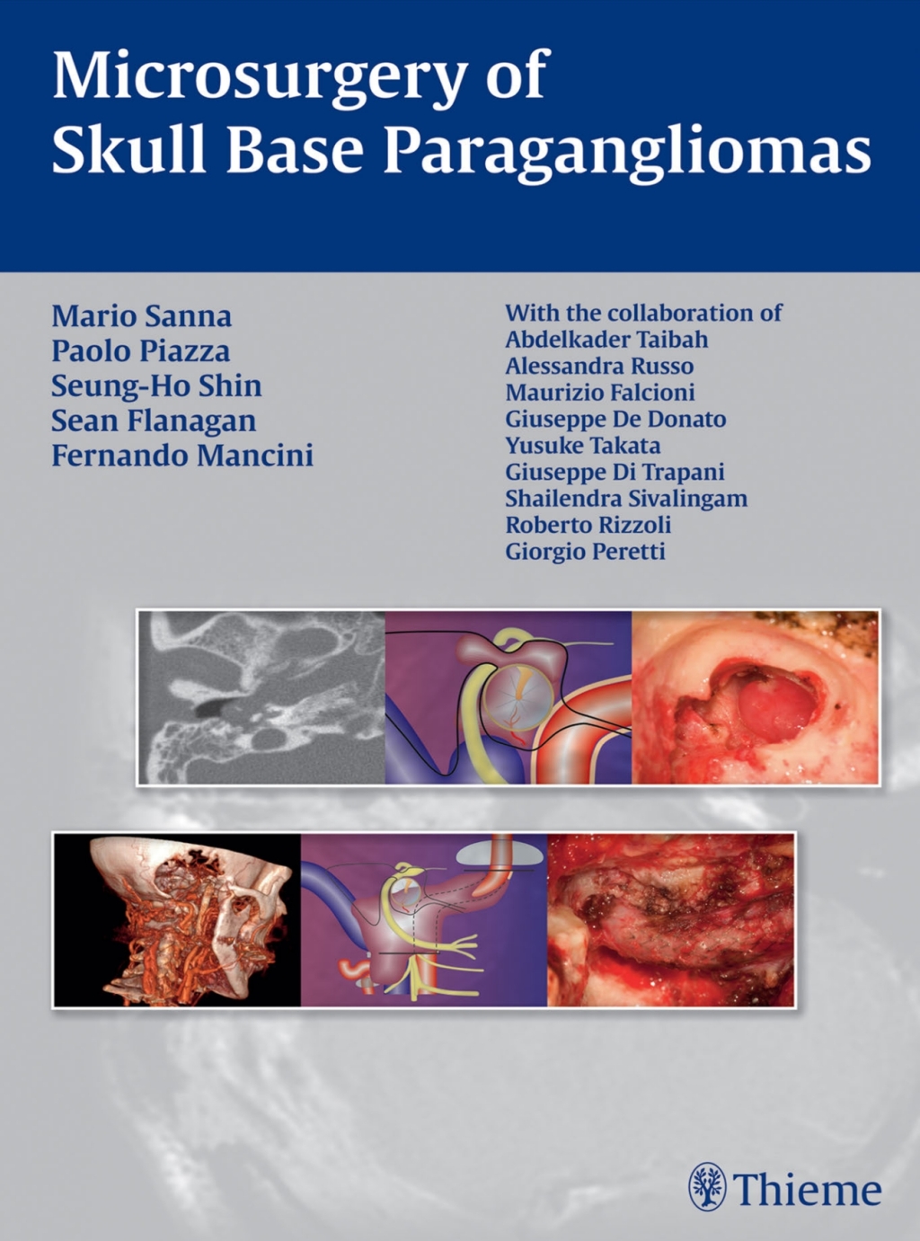 Microsurgery of Skull Base Paragangliomas 1st Edition â€“ PDF/EPUB Version Downloadable