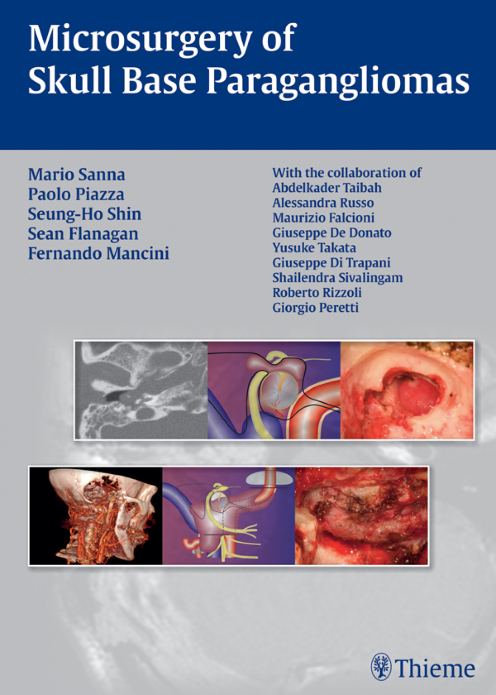 Microsurgery of Skull Base Paragangliomas 1st Edition â€“ PDF/EPUB Version Downloadable