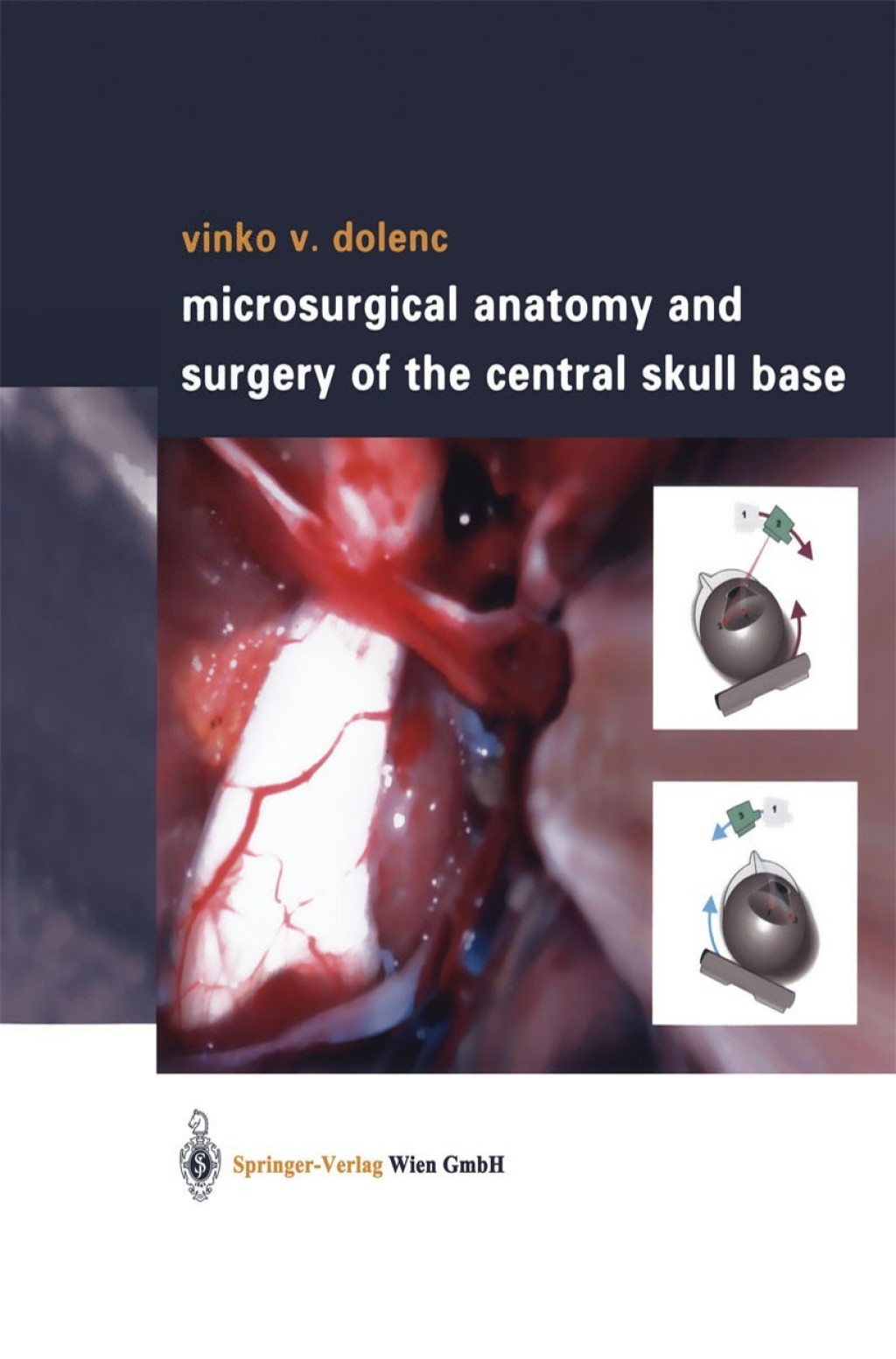 Microsurgical Anatomy and Surgery of the Central Skull Base  â€“ PDF/EPUB Version Downloadable