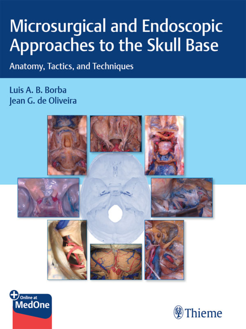 Microsurgical and Endoscopic Approaches to the Skull Base Anatomy, Tactics, and Techniques 1st Edition â€“ PDF/EPUB Version Downloadable