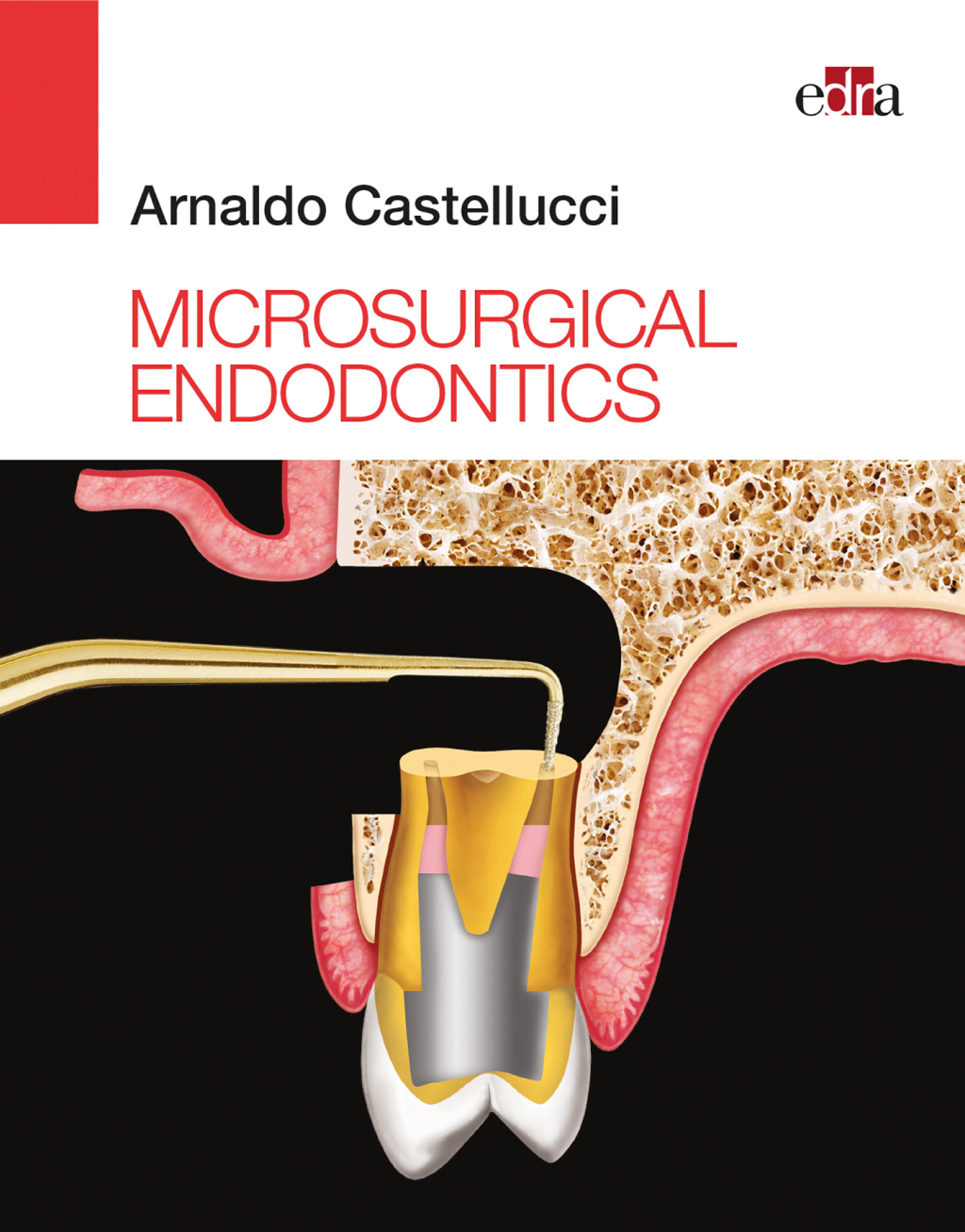 Microsurgical Endodontics 1st Edition â€“ PDF/EPUB Version Downloadable