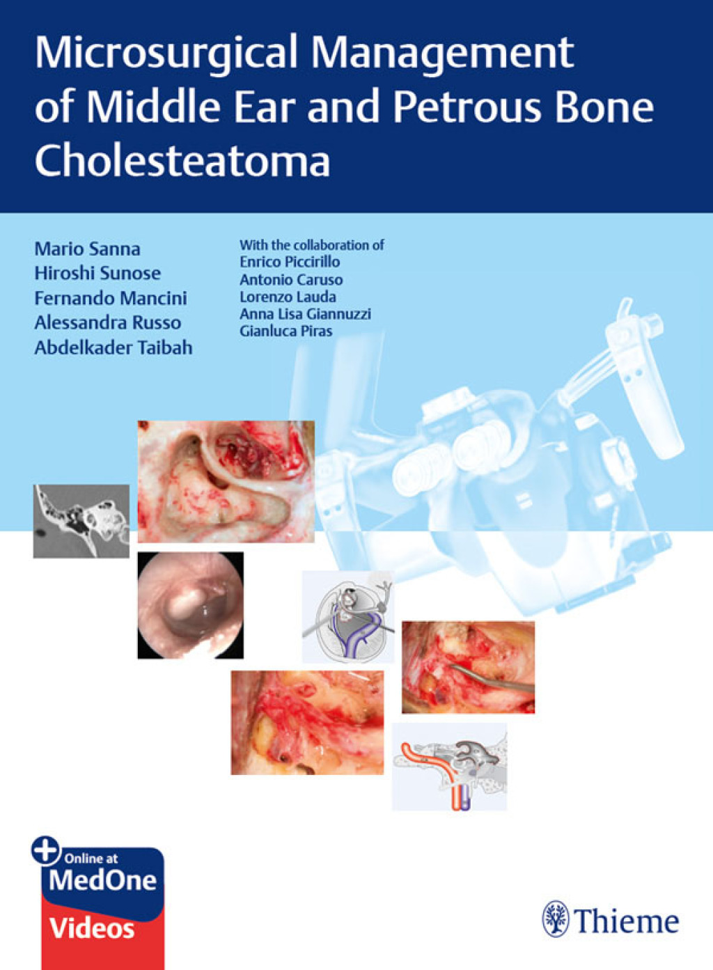 Microsurgical Management of Middle Ear and Petrous Bone Cholesteatoma 1st Edition â€“ PDF/EPUB Version Downloadable