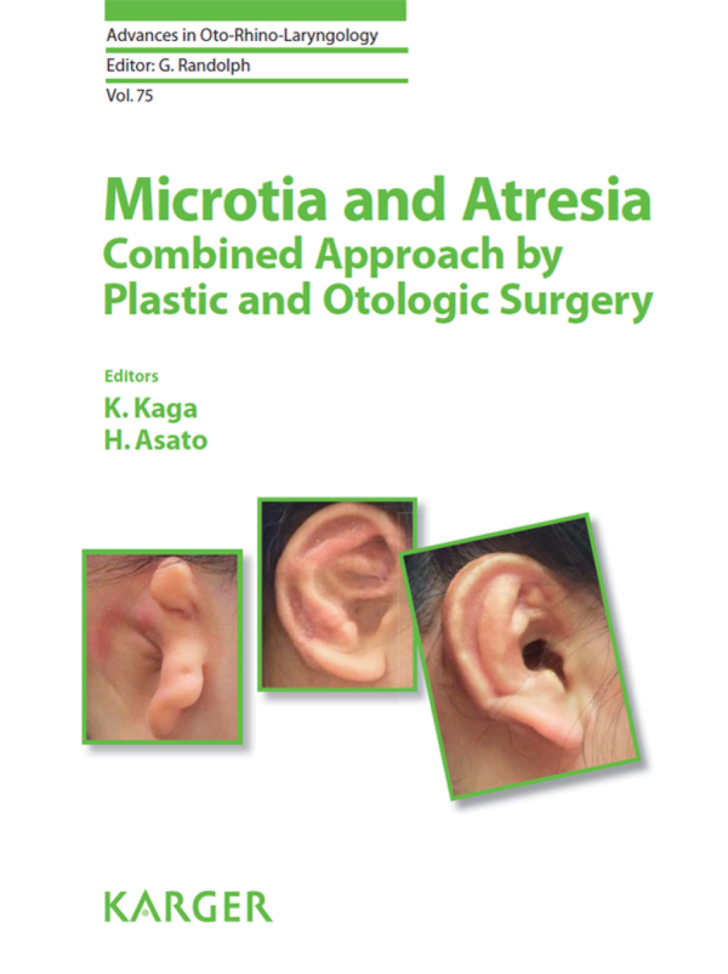 Microtia and Atresia - Combined Approach by Plastic and Otologic Surgery 1st Edition â€“ PDF/EPUB Version Downloadable