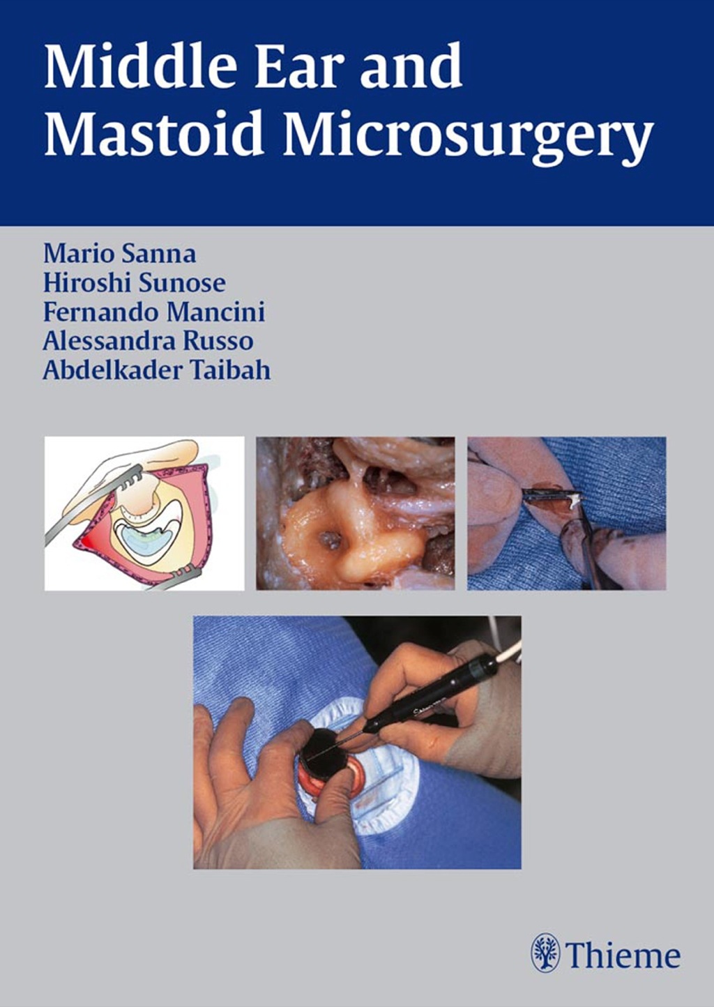 Middle Ear and Mastoid Microsurgery 1st Edition â€“ PDF/EPUB Version Downloadable