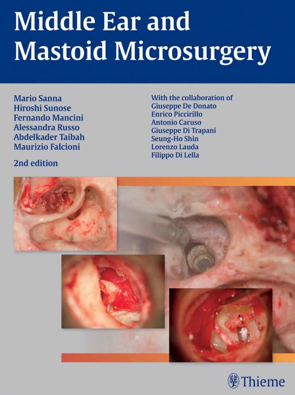 Middle Ear and Mastoid Microsurgery 2nd Edition â€“ PDF/EPUB Version Downloadable