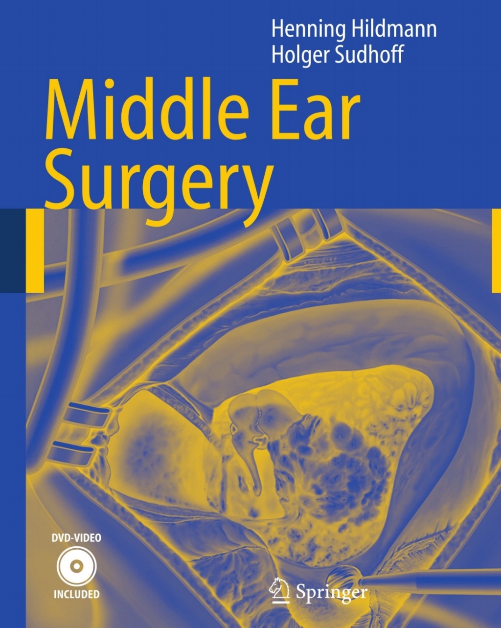Middle Ear Surgery  â€“ PDF/EPUB Version Downloadable