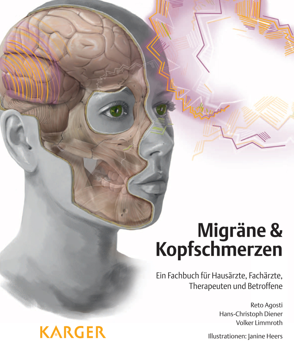 MigrÃ¤ne und Kopfschmerzen Ein Fachbuch fÃ¼r HausÃ¤rzte, FachÃ¤rzte, Therapeuten und Betroffene 1st Edition â€“ PDF/EPUB Version Downloadable