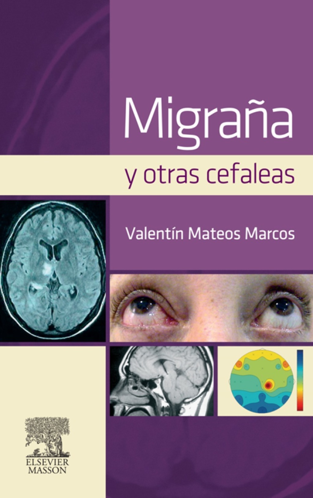 MigraÃ±a y otras cefaleas  â€“ PDF/EPUB Version Downloadable