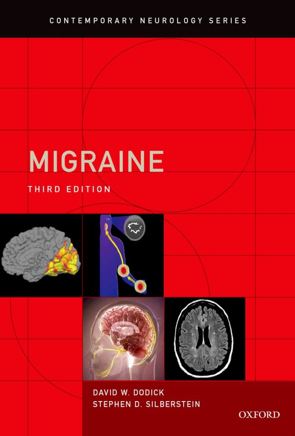 Migraine 3rd Edition â€“ PDF/EPUB Version Downloadable