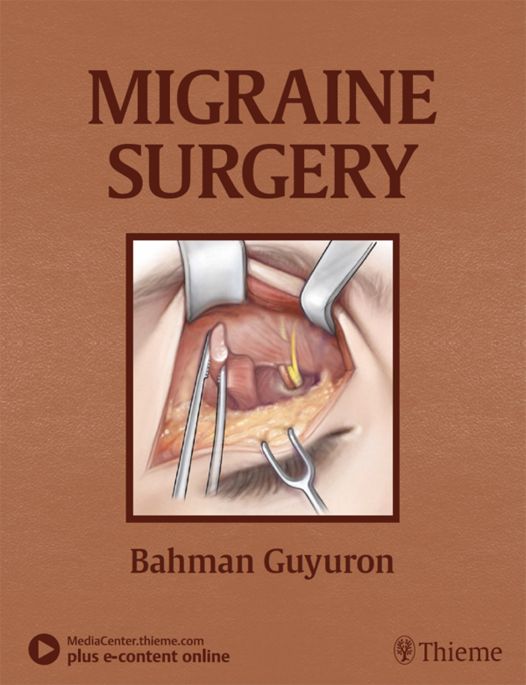 Migraine Surgery 1st Edition â€“ PDF/EPUB Version Downloadable