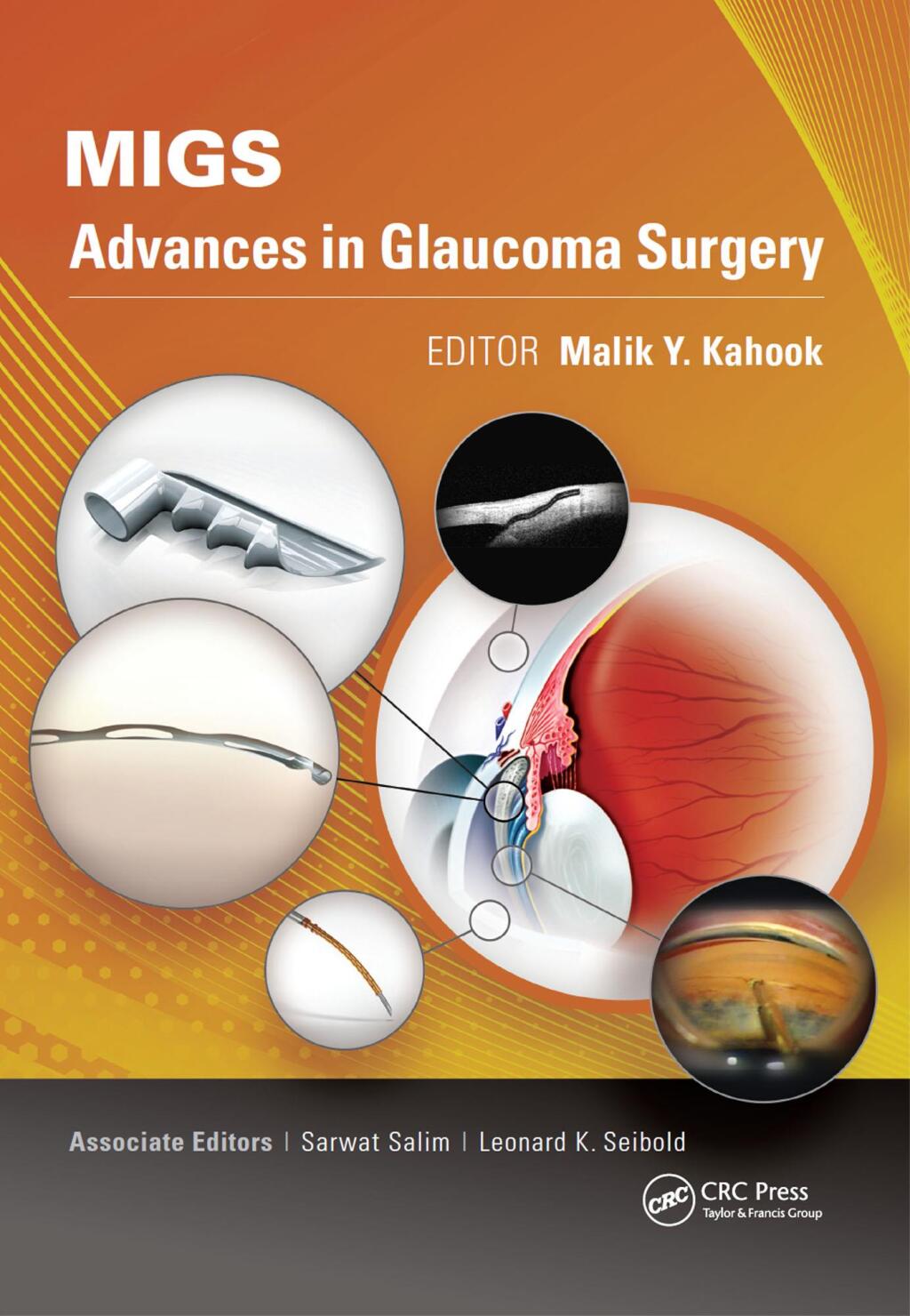 MIGS Advances in Glaucoma Surgery 1st Edition â€“ PDF/EPUB Version Downloadable