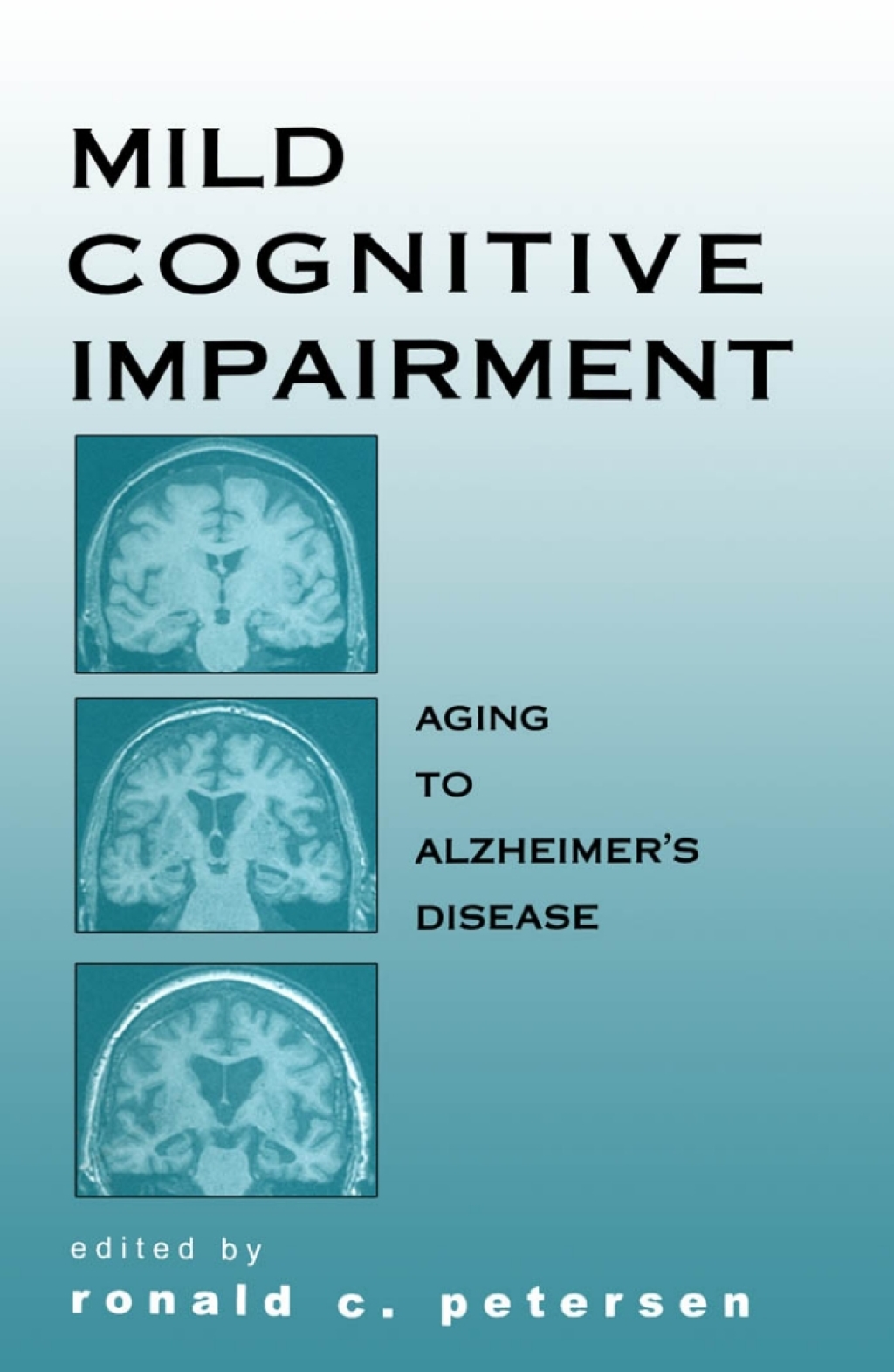 Mild Cognitive Impairment Aging to Alzheimer's Disease 1st Edition â€“ PDF/EPUB Version Downloadable