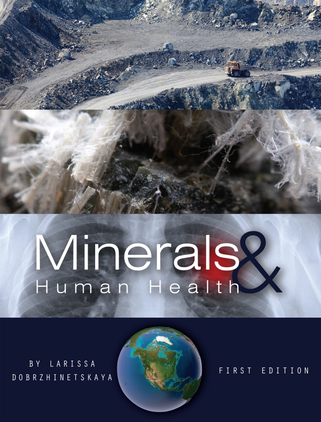 Minerals and Human Health 1st Edition â€“ PDF/EPUB Version Downloadable