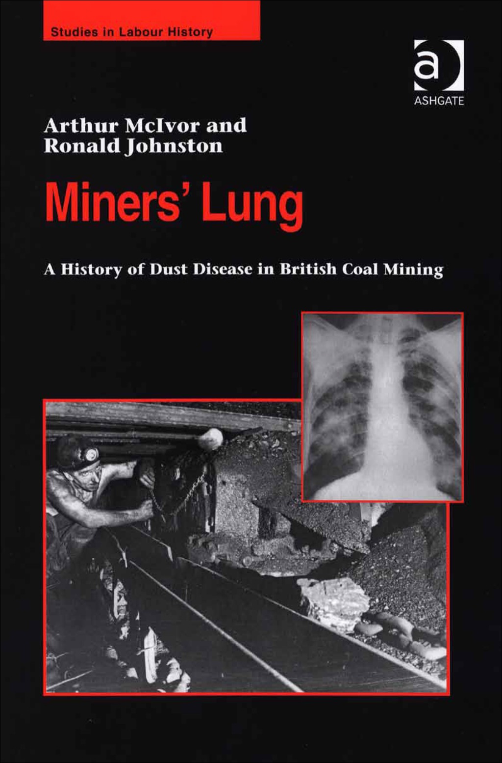 Miners' Lung: A History of Dust Disease in British Coal Mining  â€“ PDF/EPUB Version Downloadable
