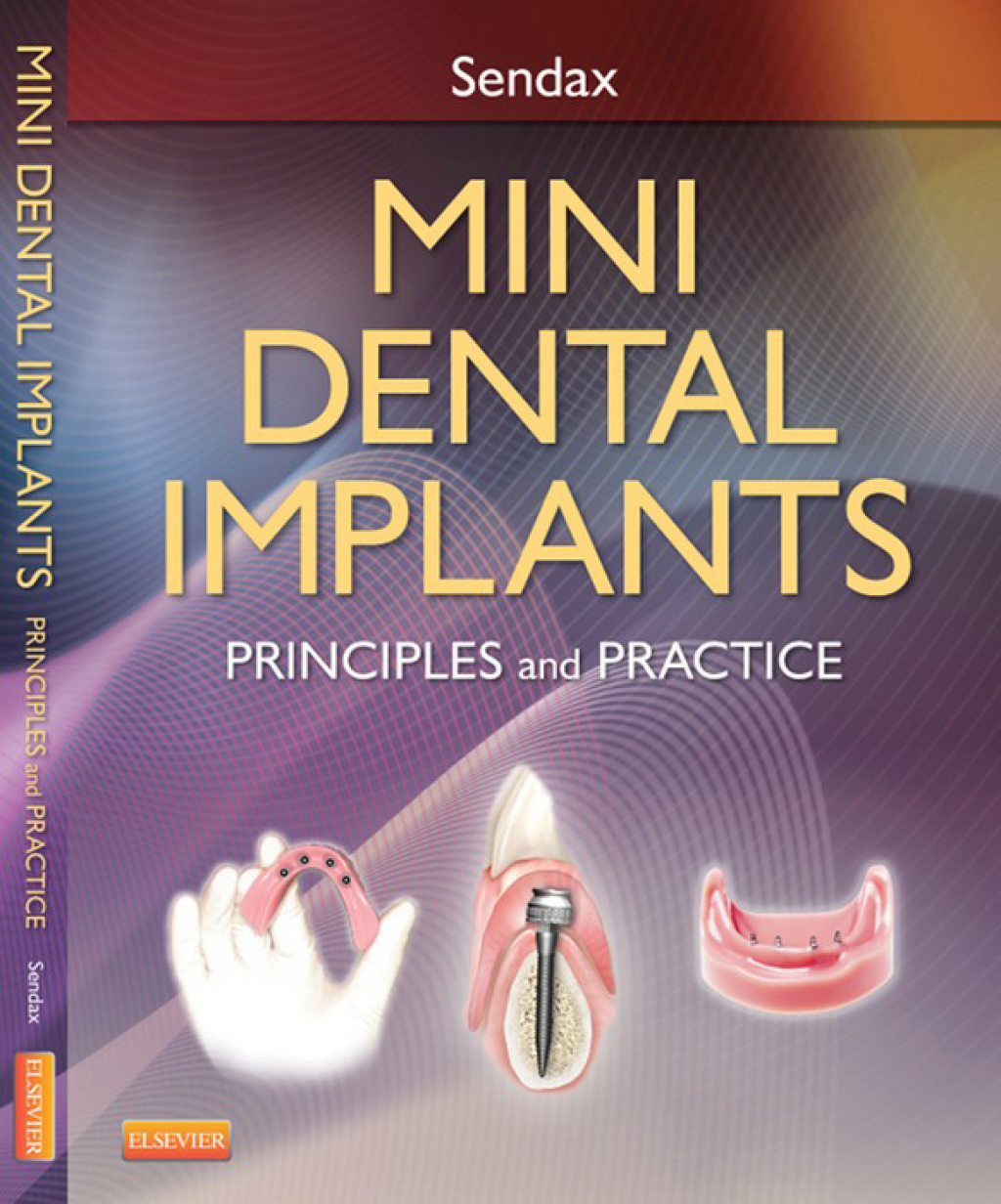 Mini Dental Implants Principles and Practices  â€“ PDF/EPUB Version Downloadable